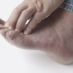 Cómo prevenir la aparición del pie diabético