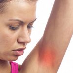 La enfermedad de la piel que afecta a 6 millones de personas