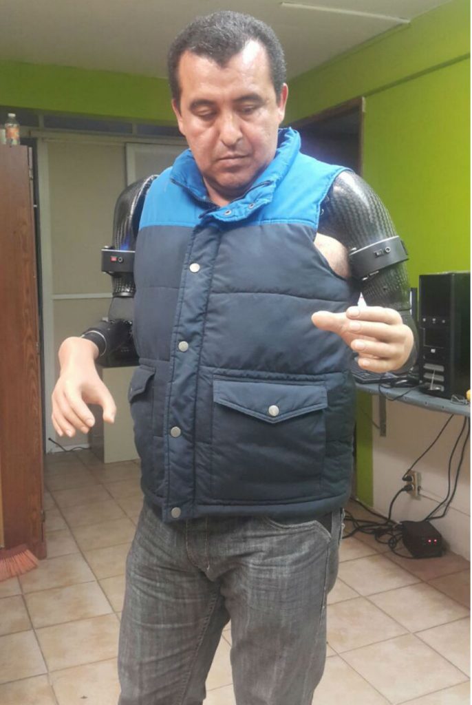 prótesis probionics