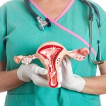 Síndrome de ovario poliquístico: significado, síntomas y tratamientos